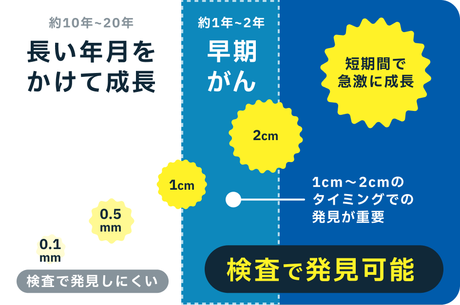 早期がんは長い年月をかけて成長、検査で発見可能
