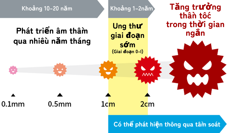 Thời gian vàng phát&nbsp;hiện sớm ung&nbsp;thư N-NOSE